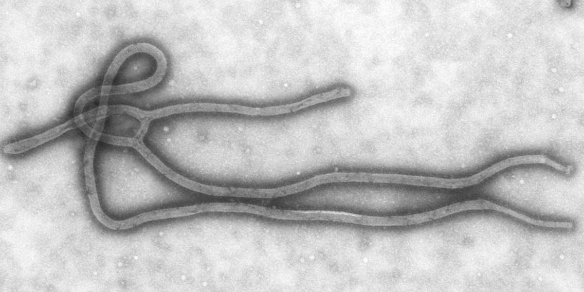 Vu au microscope, le virus Ebola est filiforme ou recourbé en U